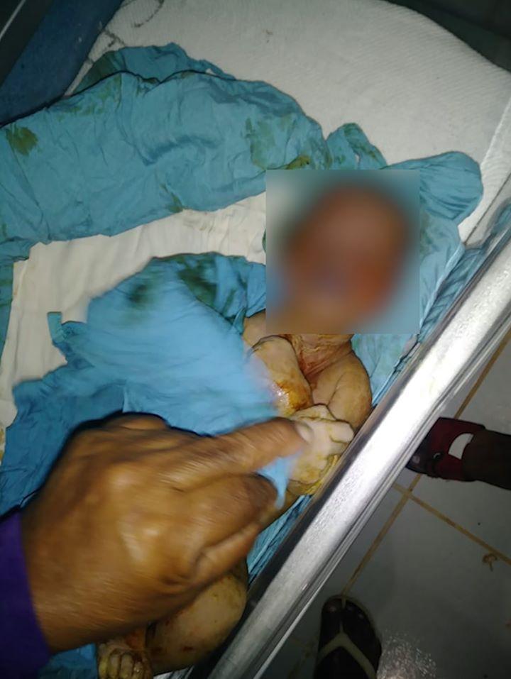 Joven pierde su bebe por negligencia y  médicos envían  el cuerpo en caja de cartón 