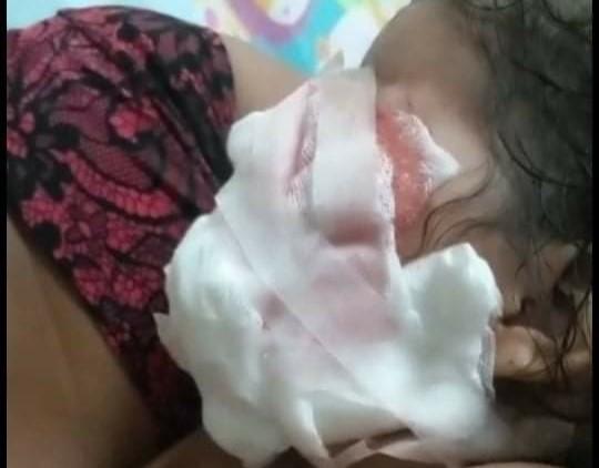 Una de las menores que fue atacada por el perro/imagen tomada de redes sociales