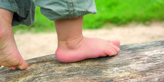 pies de un menor edad-imagen tomada de Centro Clínico