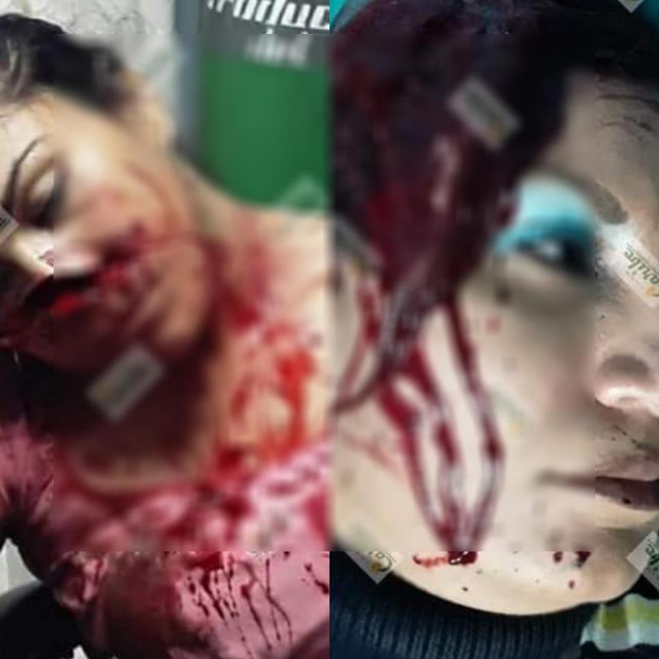 Dos mujeres  resultan con graves heridas tras ser atacadas a machetazos
