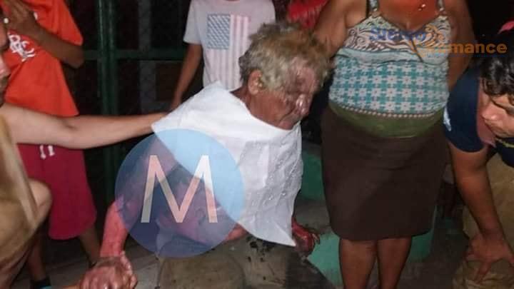 Matagalpino de 64 años murió quemado cuando una botella de licor cogió fuego en su casa