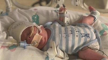 Un bebé que nació a las 23 semanas en Perú, venció el Covid-19