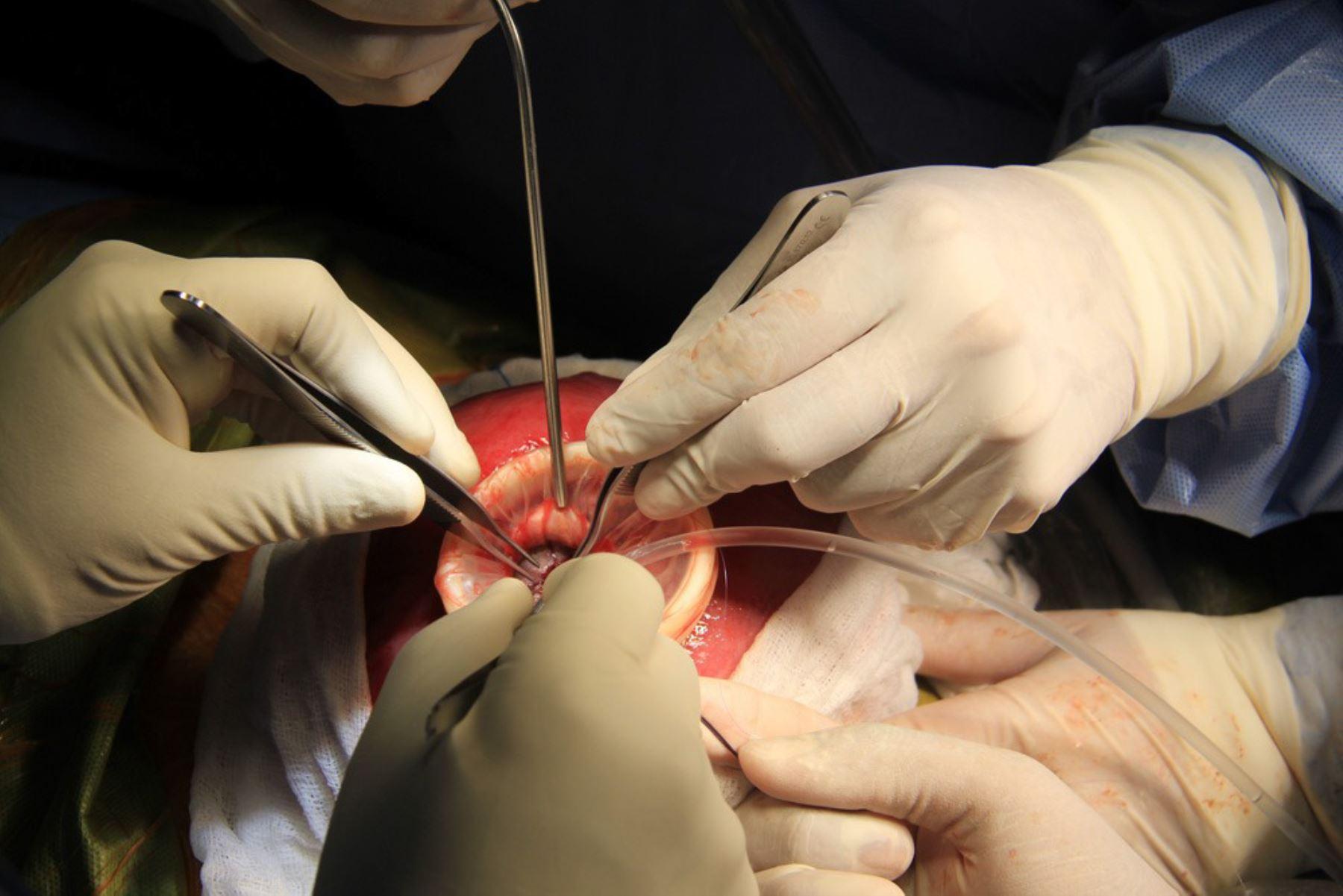 Realizarán e Nicaragua primeras cirugías fetales para reparar espina bífida/imagen de referencia tomada de Andina