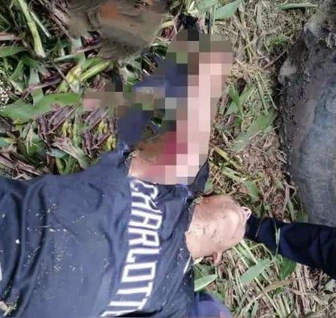 Joven muere porque una cortadora de zacate le trituró el brazo, en Matagalpa