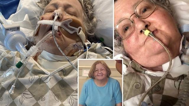 Mujer con Covid-19 pasó dos meses en coma y despertó el día en que sería desconectada 