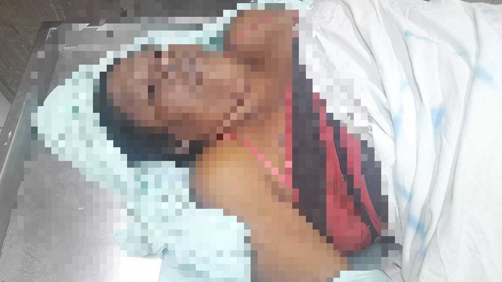 Mujer falleció al recibir descarga eléctrica de un cable desprendido en Bilwi, Caribe Norte