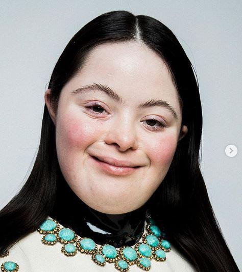 Una modelo con Síndrome de Down es la cara de la campaña de Gucci 